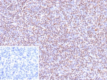 IHC staining of FFPE human tonsil tissue with recombinant Epstein-Barr Virus antibody (clone EBV/9619R). Inset: PBS used in place of primary Ab (secondary Ab negative control).