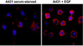 ICC test of serum-starved human A431 cells non-treated or treated with EGF, using the recombinant Phosphotyrosine antibody at 1:500 (red) and DAPI (blue).