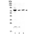 Western blot testing of 1) human HepG2, 2) human K562 and 3) mouse NIH3T3 cell lysate with FUS antibody at 0.5ug/ml. Predicted molecular weight ~53 kDa but routinely observed at up to ~75 kDa.