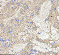 IHC staining of zebrafish Npepps protein using Zebrafish Npepps antibody, HRP-labeled secondary and DAB substrate. Npepps was detected in a paraffin-embedded section of zebrafish brain tissue. HIER: boil tissue sections in pH8 EDTA for 20 min and allow to cool before testing.