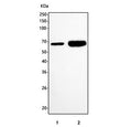 Western blot testing of 1) rat small intestine and 2) rat lung tissue lysate with Klf4 antibody. Predicted molecular weight: 50-60 kDa + possible ~75 kDa (phosphorylated form).