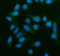 Immunofluorescent staining of OSBPL2 using anti-OSBPL2 antibody (green). OSBPL2 was detected in an immunocytochemical section of HELA cells. Enzyme antigen retrieval was performed using IHC enzyme antigen retrieval reagent for 15 mins. The cells were blocked with 10% goat serum. And then incubated with 5 ug/ml rabbit anti-OSBPL2 antibody overnight at 4oC. DyLight 488 Conjugated Goat Anti-Rabbit IgG was used as secondary antibody at 1:500 dilution and incubated for 30 min at 37oC.