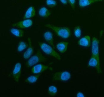 Immunofluorescent staining of OSBPL2 using anti-OSBPL2 antibody (green). OSBPL2 was detected in an immunocytochemical section of HELA cells. Enzyme antigen retrieval was performed using IHC enzyme antigen retrieval reagent for 15 mins. The cells were blocked with 10% goat serum. And then incubated with 5 ug/ml rabbit anti-OSBPL2 antibody overnight at 4oC. DyLight 488 Conjugated Goat Anti-Rabbit IgG was used as secondary antibody at 1:500 dilution and incubated for 30 min at 37oC.