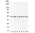 Western blot testing of SOX7 antibody and Lane 1: rat brain; 2: human placenta; 3: (r) lung; 4: (r) testis; 5: (h) HeLa; 6: (h) A549; 7: (h) HEPG2; 8: (h) SMMC-7721; 9: mouse Neuro-2a lysate