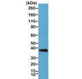 Western blot testing of human HeLa cell lysate with recombinant Synaptophysin antibody. Predicted molecular weight: 34-38 kDa.