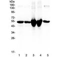 Western blot testing of 1) rat liver, 2) rat liver (different lot), 3) mouse liver, 4) mouse liver (different lot) and 5) human placenta lysate with Vitamin D binding protein antibody at 0.5ug/ml. Predicted molecular weight ~53 kDa.