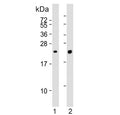 Western blot testing of human 1) lung and 2) K562 cell lysate with Pulmonary surfactant-associated protein C antibody. Predicted molecular weight ~21 kDa.