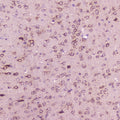 IHC testing of FFPE mouse brain with Calcitonin antibody at 2ug/ml. HIER: steamed antigen retrieval with pH6 citrate buffer.