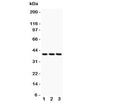 Western blot testing of CXCR6 antibody and Lane 1: HeLa; 2: Jurkat; 3: MCF-7 lysate. Expected/observed molecular weight: ~39 kDa.