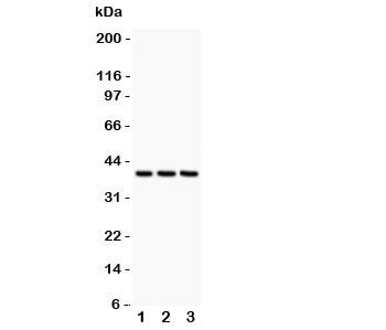 Western blot testing of CXCR6 antibody and Lane 1: HeLa; 2: Jurkat; 3: MCF-7 lysate. Expected/observed molecular weight: ~39 kDa.