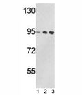 Western blot analysis of VCP antibody and 1) Jurkat, 2) 293, and 3) MDA-MB231 lysate. Predicted/observed molecular weight: ~89/97kDa.
