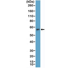 Western blot testing of human Jurkat cell lysate with recombinant TdT antibody at 1:2000 dilution. Predicted molecular weight: ~56 kDa.