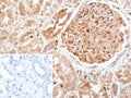 IHC staining of FFPE human kidney tissue with CASP7 antibody (clone CASP7/9054). Inset: PBS used in place of primary Ab (secondary Ab negative control). HIER: boil tissue sections in pH 9 10mM Tris with 1mM EDTA for 20 min and allow to cool before testing.