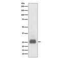 Western blot testing of lysate from TPA-treated human HL60 cells with TIMP1 antibody. Expected molecular weight: 23-28 kDa depending on the level of glycosylation.