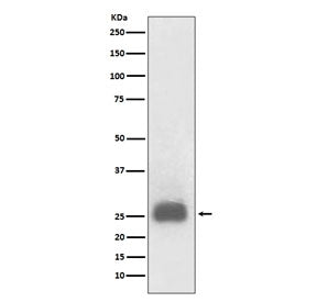 Western blot testing of lysate from TPA-treated human HL60 cells with TIMP1 antibody. Expected molecular weight: 23-28 kDa depending on the level of glycosylation.