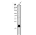 Rat brain tissue lysate tested with CRP antibody at 1:1000 dilution for 1 hour at room temperature. A predominant band is detected at ~17 kDa, consistent with proteolytically processed CRP fragments; other antibodies may detect the ~23-26 kDa monomer under the same conditions.