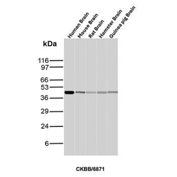 Western blot analysis of Human Brain, Mouse Brain, Rat Brain, Hamster Brain and Guinea pig Brain tissue lysates using CK-BB antibody (clone CKBB/6871). Predicted molecular weight ~43 kDa.