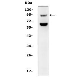 Western blot testing of mouse kidney tissue lysate with SLC9A2 antibody. Expected molecular weight ~92 kDa.