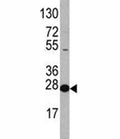 Western blot analysis of EIF4E antibody and HL-60 lysate. Predicted molecular weight ~27 kDa.