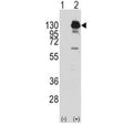 Western blot analysis of PDGFR alpha antibody and 293 cell lysate (2 ug/lane) either nontransfected (Lane 1) or transiently transfected with the human gene (2). Predicted molecular weight: 120-195 kDa.
