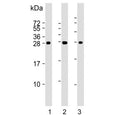 Western blot testing of mouse 1) kidney, 2) stomach and 3) liver lysate with PSCA antibody. Expected molecular weight: 13-29 kDa depending on glycosylation level.