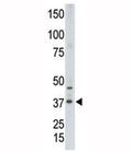 Western blot testing of CDX2 antibody and human placenta tissue lysate. Predicted molecular weight: 33-40 kDa.