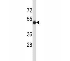 CD43 antibody western blot analysis in MDA-MB435 lysate. Predicted molecular weight 45-115 kDa depending on glycosylation level.