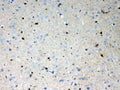 IHC testing of FFPE rat brain tissue with HCN2 antibody at 1ug/ml. Required HIER: steam section in pH6 citrate buffer for 20 min and allow to cool prior to testing.