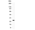 Western blot testing of Prolactin antibody and MCF7 lysate. Predicted/observed molecular weight: ~25kDa.