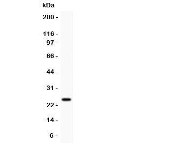 Western blot testing of Prolactin antibody and MCF7 lysate. Predicted/observed molecular weight: ~25kDa.