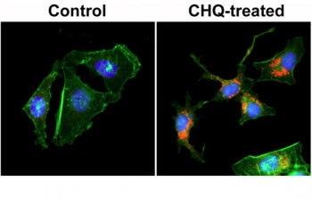 ICC staining of human HeLa cells untreated or treated with chloroquine (CHQ), with recombinant LC3B antibody (red) at 1:200 dilution. Actin filaments have been labeled with fluorescein phalloidin (green), and nucleus labeled with DAPI (blue).