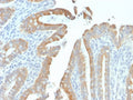 IHC testing of FFPE human colon tissue with recombinant Cytokeratin 19 antibody (clone rKRT19/799). Required HIER: boil tissue sections in pH 9 10mM Tris with 1mM EDTA for 10-20 min followed by cooling at RT for 20 min.