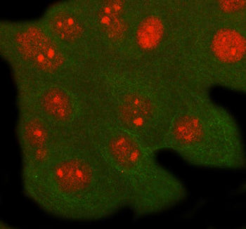 Immunofluorescent staining of RFXANK using anti-RFXANK antibody (red) and anti-Beta Tubulin antibody (green). RFXANK was detected in immunocytochemical section of cell. Enzyme antigen retrieval was performed using IHC enzyme antigen retrieval reagent for 15 mins. The cells were blocked with 10% goat serum. And then incubated with 5 ug/ml rabbit anti-RFXANK antibody and mouse anti-Beta Tubulin antibody overnight at 4oC.