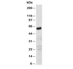 Western blot testing of CD147 antibody and human fibroma cell lysate. Predicted molecular weight: ~27 kDa (unmodified), 43-66 kDa (glycosylated).