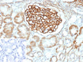 IHC staining of FFPE human kidney tissue with PLA2R1 antibody (clone PLA2R1/4893). Inset: PBS used in place of primary Ab (secondary Ab negative control). HIER: boil tissue sections in pH 9 10mM Tris with 1mM EDTA for 20 min and allow to cool before testing.