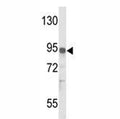 Western blot analysis of IL17RD antibody and MDA-MB231 lysate.