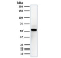 Western blot testing of human A431 cell lysate with TOX3 antibody. Predicted molecular weight ~63 kDa.