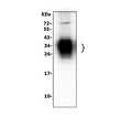 Western blot testing of SFTPA1 antibody and Lane 1: rat lung; 2: rat lung (different lot); 3: human Raji lysate. Predicted molecular weight: ~26 kDa but may be observed at higher molecular weights due to glycosylation.