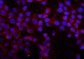 Immunofluorescent staining of FFPE human A431 cells with MMP16 antibody (red) and DAPI nuclear stain (blue). HIER: steam section in pH6 citrate buffer for 20 min.
