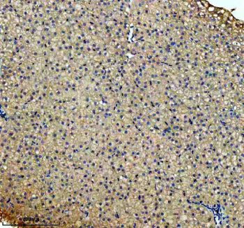 IHC staining of FFPE zebrafish liver tissue with Zebrafish Cbs antibody. HIER: boil tissue sections in pH8 EDTA for 20 min and allow to cool before testing.