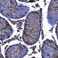 IHC staining of FFPE mouse testis tissue with TRIM71 antibody. HIER: boil tissue sections in pH8 EDTA for 20 min and allow to cool before testing.