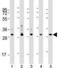 Western blot testing of human 1) MCF-7, 2) liver, 3) lung, 4) placenta and 5) kidney lysate with WBP1 antibody at 1:4000. Predicted molecular weight: 29 kDa.