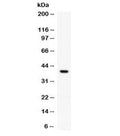 Western blot testing of rat brain lysate with RANKL antibody at 0.5ug/ml. Expected molecular weight: 35-40 kDa.