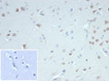 IHC staining of FFPE human cerebellum tissue with recombinant Fox3 antibody (clone NeuN/7071R). Negative control inset: PBS used in place of primary Ab. HIER: boil tissue sections in pH 9 10mM Tris with 1mM EDTA for 20 min and allow to cool before testing.
