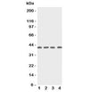 Western blot testing of p53R2 antbody; Lane 1: rat thymus; 2: human MCF-7; 3: (h) A431; 4: (h) HeLa cell lysate. Expected/observed size ~40KD