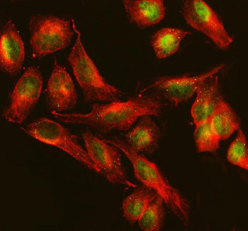 Immunofluorescent staining of TTC34 using anti-TTC34 antibody (green) and anti-Beta Tubulin antibody (red). TTC34 was detected in an immunocytochemical section of U2OS cells. Enzyme antigen retrieval was performed using IHC enzyme antigen retrieval reagent for 15 mins. The cells were blocked with 10% goat serum. And then incubated with 5 ug/ml rabbit anti-TTC34 antibody and mouse anti-Beta Tubulin antibody overnight at 4oC.