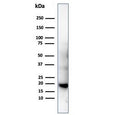 Western blot testing of His-tagged protein using recombinant Poly His antibody (clone 6HIS/6402R).