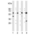 Western blot testing of 1) human kidney, 2) human placenta, 3) mouse kidney and 4) rat kidney lysate with CRTR1 antibody. Predicted molecular weight ~55 kDa.