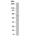 Western blot testing of human A431 cell lysate with PTEN antibody at 1ug/ml. Expected molecular weight: 47~55 kDa (isoform 1), 65~70 kDa ('long' isoform).