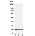 Western blot testing of IL4 antibody and Lane 1: recombinant human protein 10ng; 2: 5ng; 3: 2.5ng. Expected molecular weight: 14-20 kDa depending on glycosylation level.